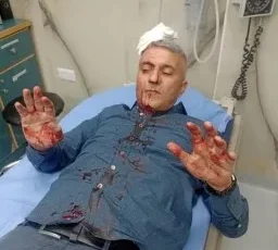 اعتداء على مراسل أردني من قِبل أربعة ملثمين مجهولين